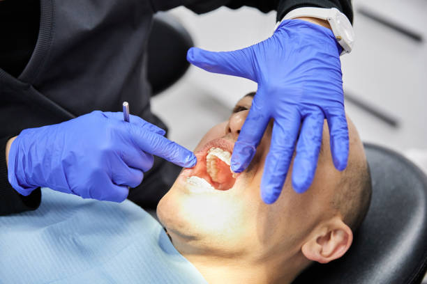 Best Emergency Broken Tooth Repair in Coral Springs, FL